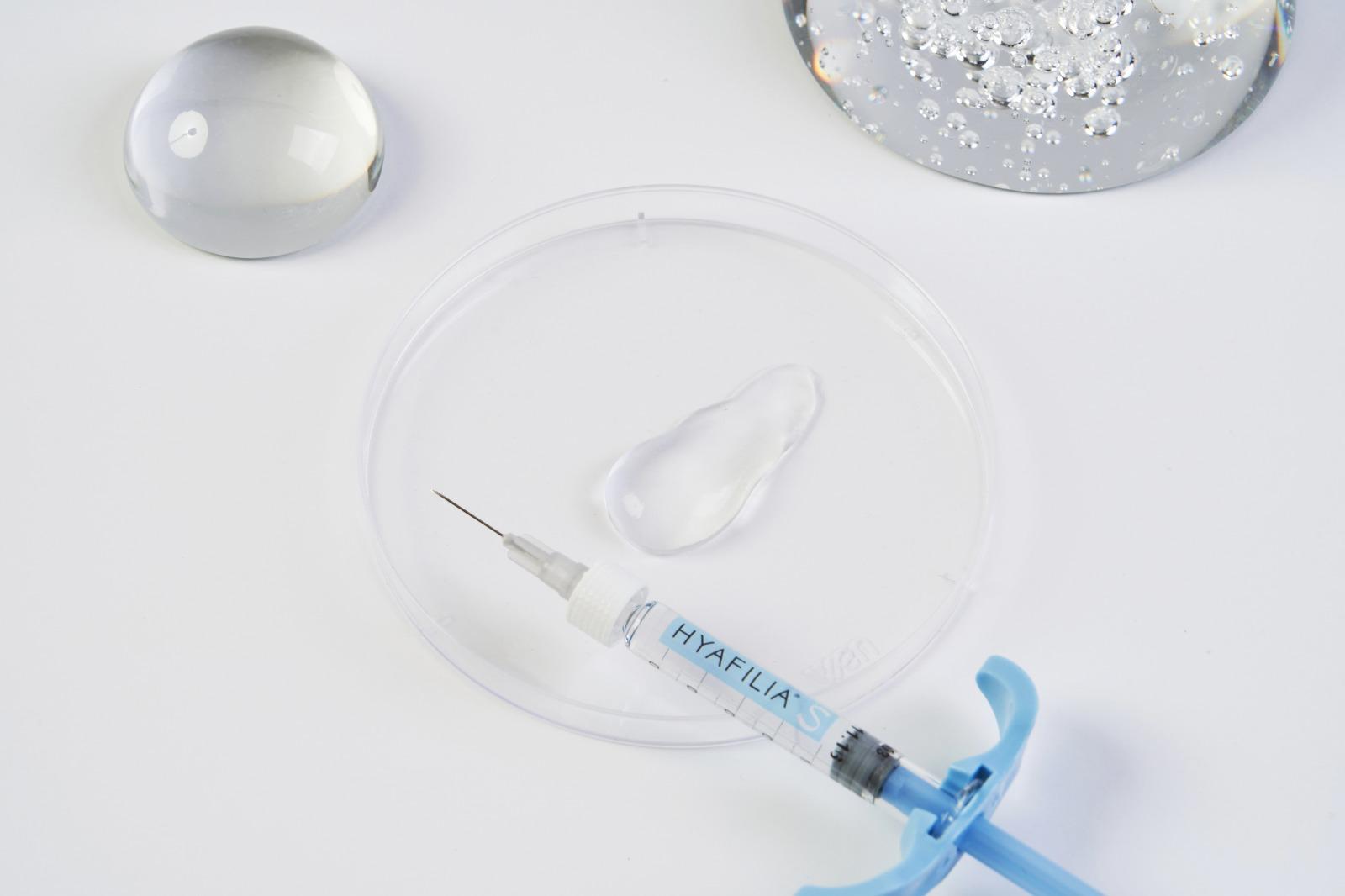 Hyafilia Soft Plus with Lidocaine syringe – soft HA filler for lips, perioral lines, and delicate facial contouring with natural movement.
