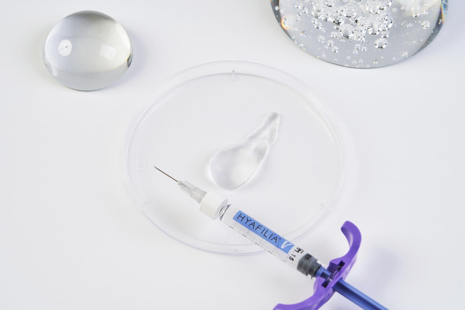 Hyafilia Volume Plus with Lidocaine syringe – hydrating hybrid dermal filler with free hyaluronic acid for radiant, plump, and deeply moisturised skin.